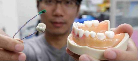 谷歌智能牙齿专利曝光 可用于动作识别1