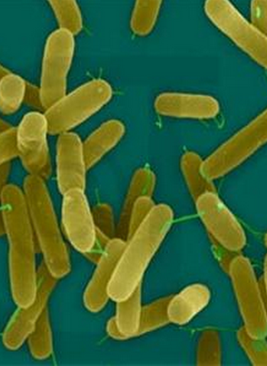 舟山市饮用水3批次检出“铜绿假单胞菌”超标