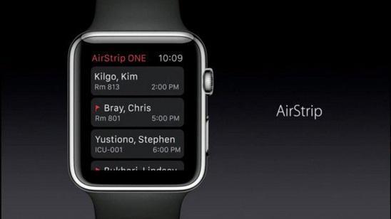 对Apple Watch 2的期待和预测 好想要圆形表盘4