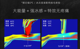 有兰博基尼背书的JOVS脱毛仪，“多功能”成为用户新选择