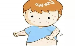 牛奶过敏宝宝奶粉推荐哪种?避开3大误区,科学答案在这